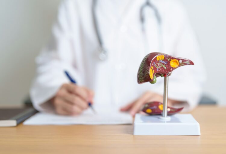 Doctor with human Liver anatomy model. Liver cancer